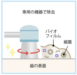 クリーニングの画像