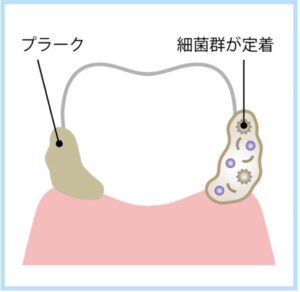 プラークの画像